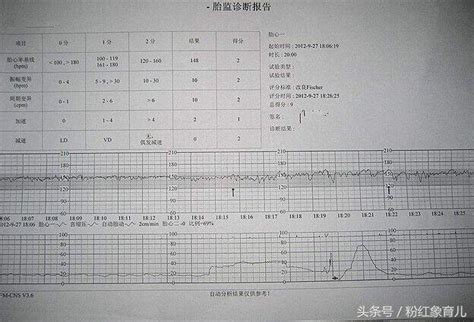 懷孕生男症狀|六個懷男初期症狀，讓您一眼就明白！